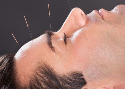 Acupuncture for other conditions