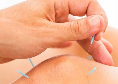 Acupuncture treatment around knee