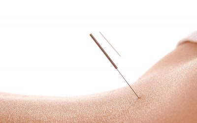 New Acupuncture website