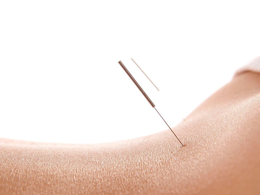 New Acupuncture website