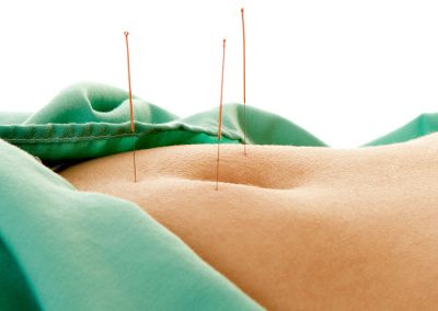 Acupuncture for women's health