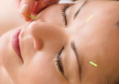 Acupuncture for women's health